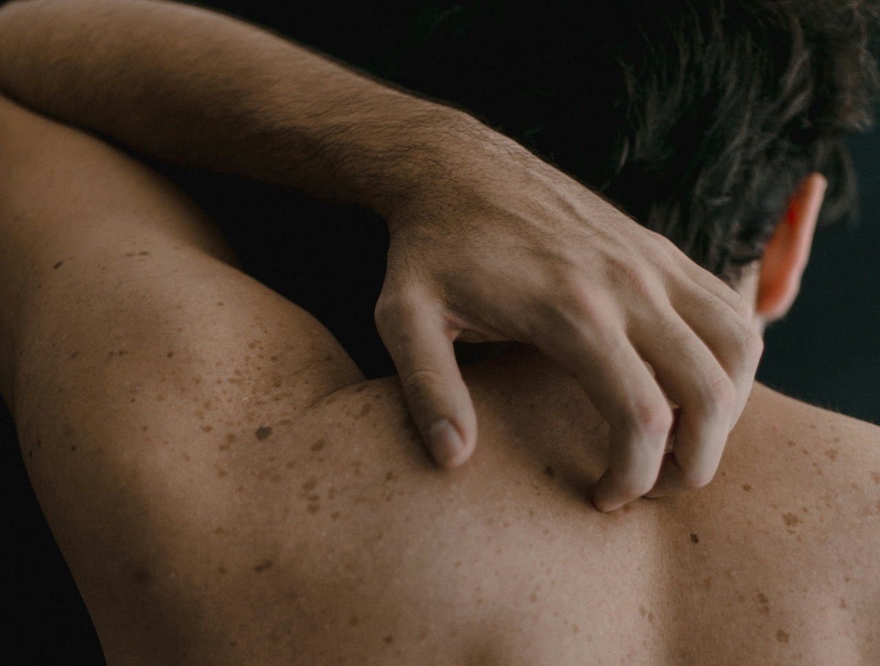 O cancro da pele pode prevenir-se, mas estes 7 mitos continuam a atrapalhar. Falámos com uma especialista