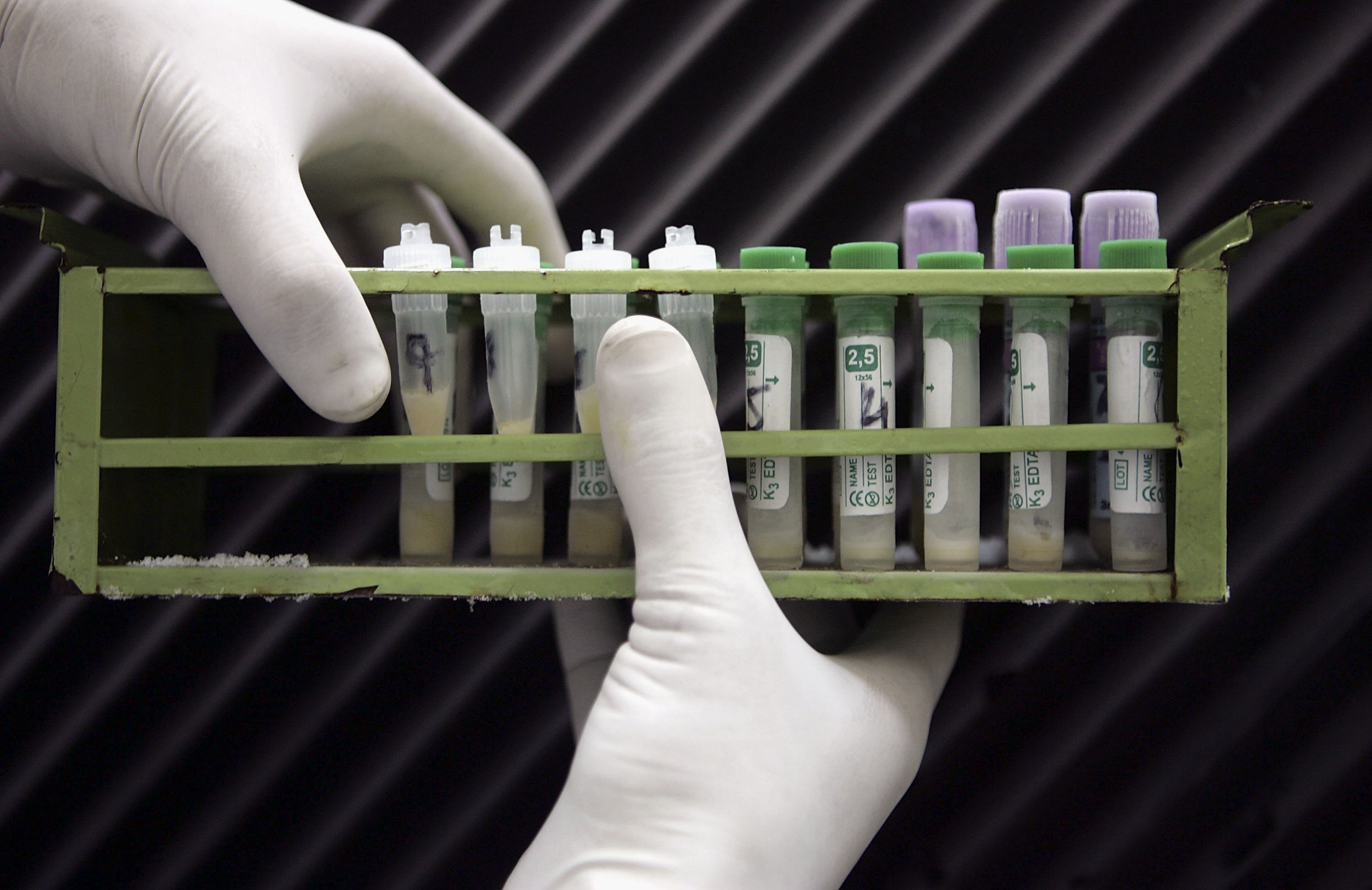 Nova Zelândia lança o primeiro banco de esperma HIV positivo