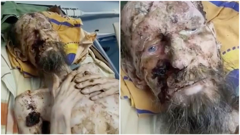 Alexander foi encontrado neste estado depois de ser atacado por um urso