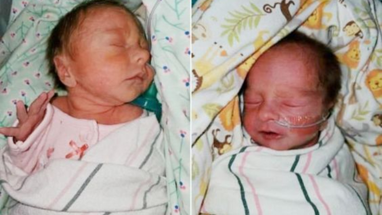Os gémeos Joslyn e Jaxon