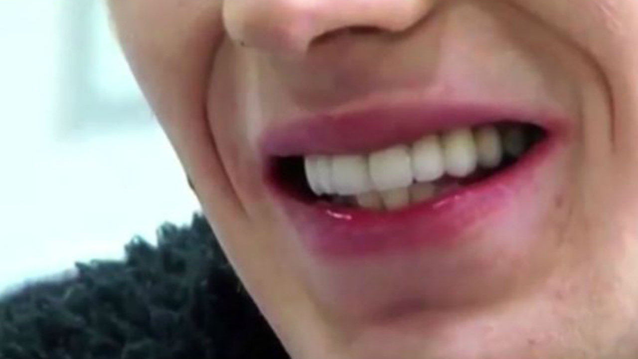 O novo sorriso de Jay
