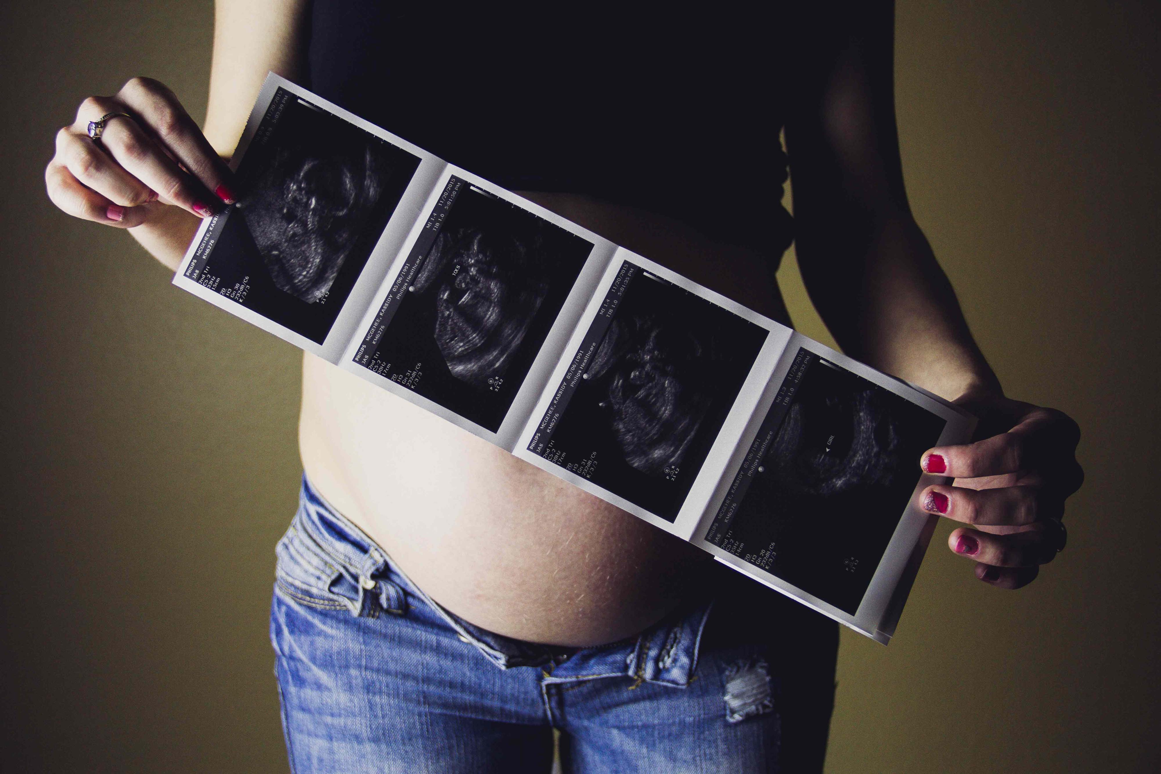 COVID-19. Colégio de Obstetrícia sugere à DGS que grávidas prescindam da terceira ecografia