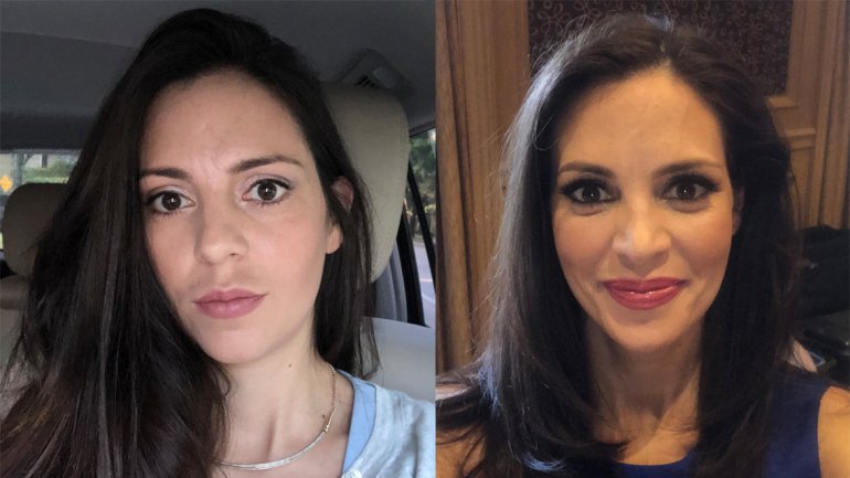 O antes e o depois da cirurgia plástica 