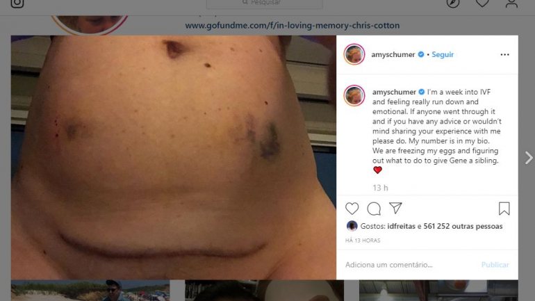 Esta foi a fotografia que Amy Schumer usou para partilhar o que sentia com os seguidores