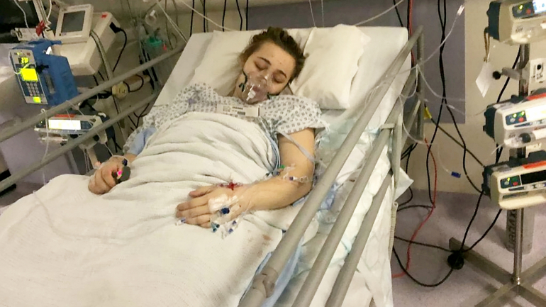 Ebony Steveson ficou em coma induzido durante quatro dias