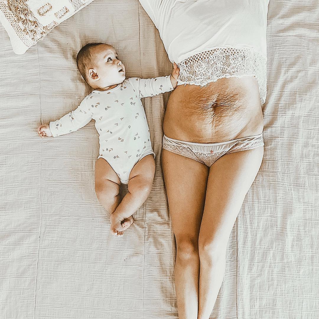 “Nojenta”, “feia”. Depois de 5 filhos, esta é a barriga de Brenda