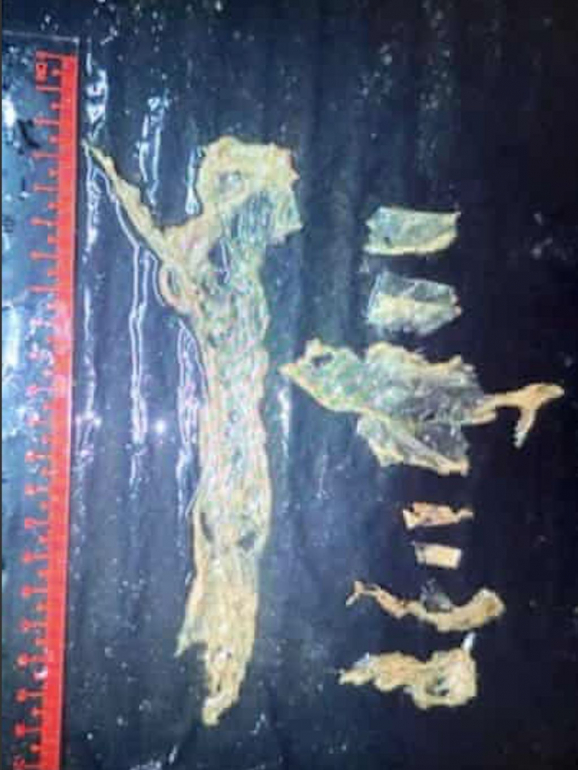 Os pedaços de plástico encontrados no estômago de Marium