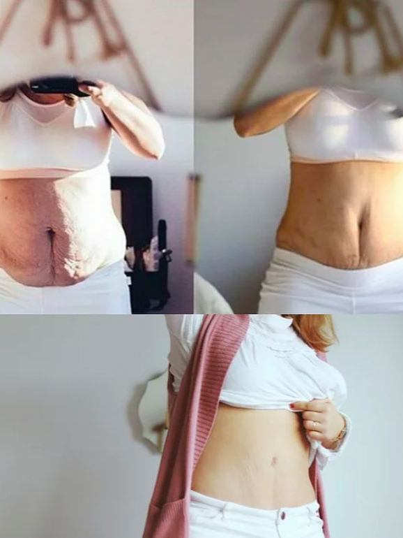 A evolução da barriga de Catarina Macedo Ferreira