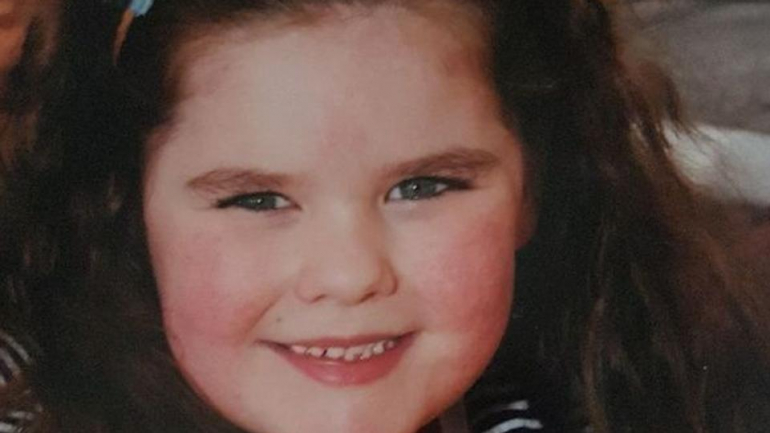 Aos 3 anos sofria de acne, como se fosse uma adolescente igual a tantas outras