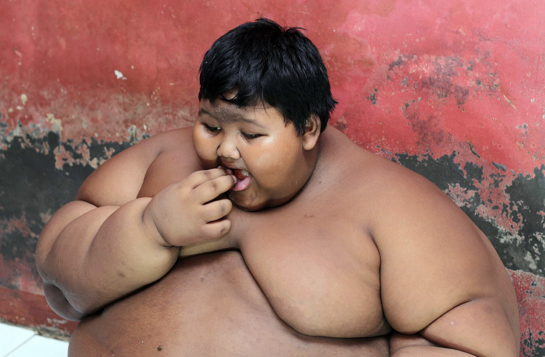 Criança que pesava 190 quilos aos 11 anos está irreconhecível depois de dietas e cirurgias