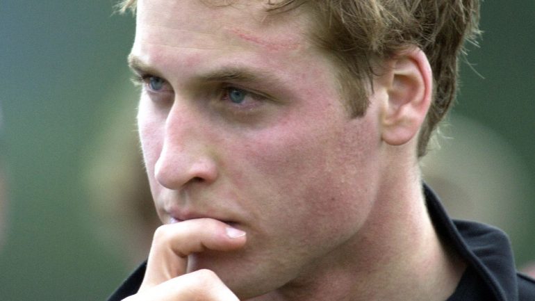 William fez a sua cicatriz durante um jogo de golfe