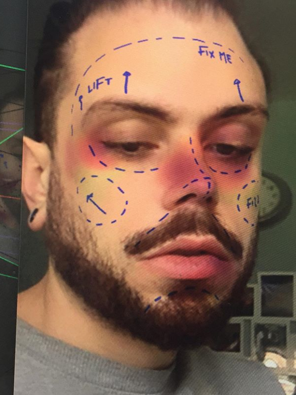 'Saiu o filtro 'fix me' — vem experimentar a nova fantasia de cirurgia plástica', escreve Daniel Mooney na descrição da fotografia