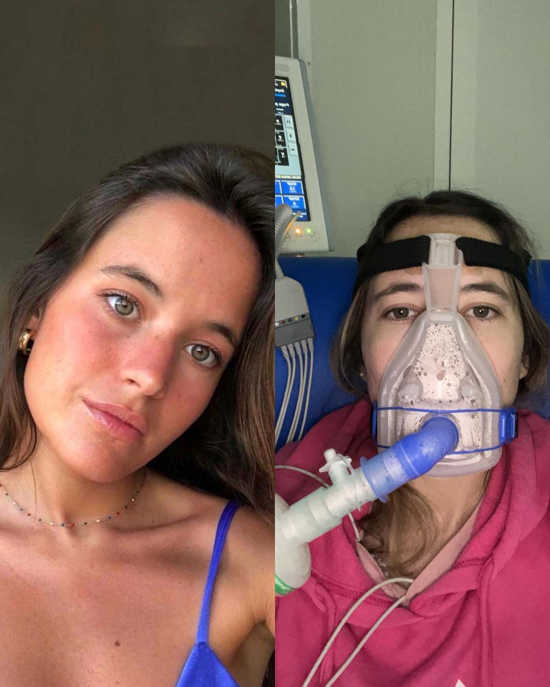 Esperança para Constança. Infarmed aprova medicamento para a fibrose quística