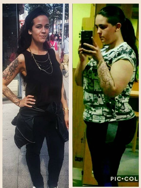 Histórias inspiradoras de 3 mulheres que eram obesas, perderam peso e nunca mais engordaram