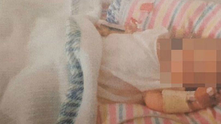 Com 19 meses, a criança tinha o aspeto de uma bebé de 3 meses